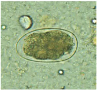 Gambar 2.5 &amp; 2.6 : gambar telur  Hookworm sulit dapat dibedakan antara telur N. 