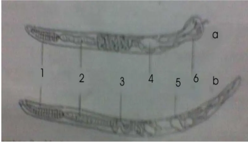 Gambar 3 : morfologi cacing tambang dewasa ; a. cacing betina.  b. 