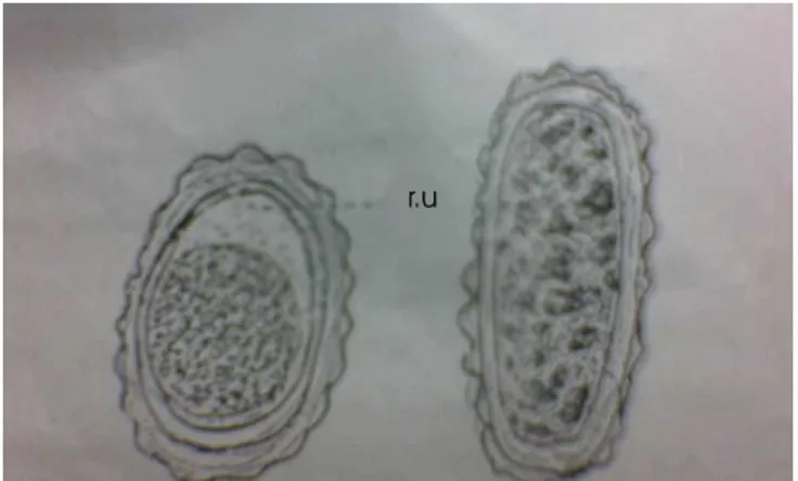 Gambar 4 : morfologi telur cacing  A. lumbricoides  ; 1. telur yang  dibuahi.  2. telur yang tidak dibuahi