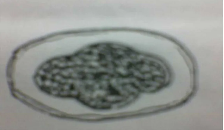 Gambar 6 : morfologi telur cacing tambang.