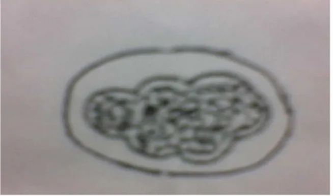 Gambar 8 : morfologi telur cacing S. stercoralis