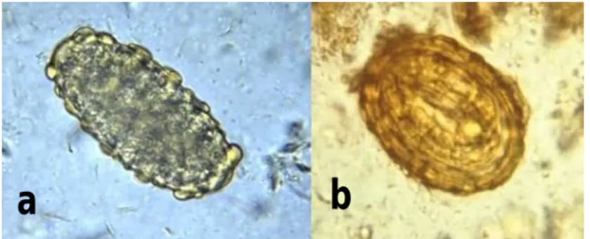 Gambar 2.2 Telur cacing Ascaris lumbricoides. (a) telur yang tidak dibuahi,  (b) telur yang dibuahi 