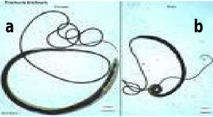 Gambar 2.3 Cacing Trichuris trichiura dewasa. (a) betina, (b) jantan  (http://www.An.American.FamilyPhysician) 