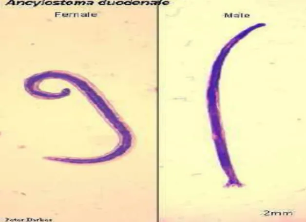 Gambar 2.5 Cacing Ancylostoma duodenale dewasa  (http://www.An.American.FamilyPhysician.) 