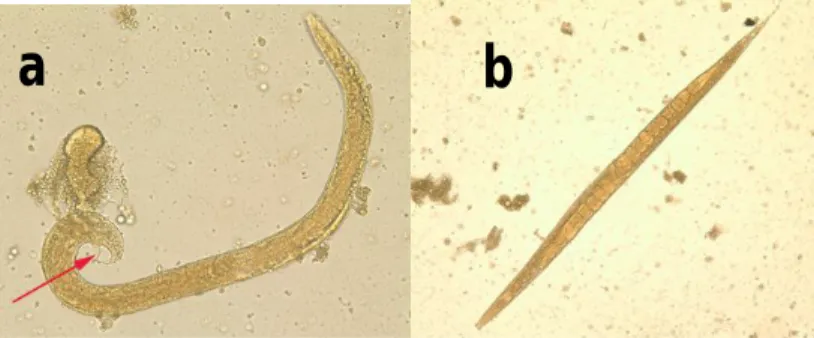 Gambar 2.9 Cacing Strongyloides stercoralis dewasa. (a) jantan  (memiliki spekulum), (b) betina 