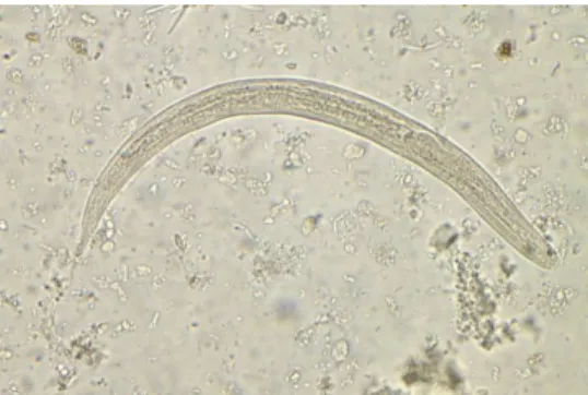 Gambar 2.10 Larva rabditiform 