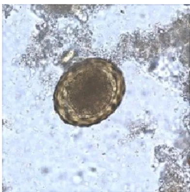 Gambar 2. Telur Ascaris lumbricoides (CDC, 2009)