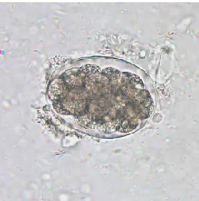 Gambar 5. Telur cacing tambang (hookworm) (CDC, 2010) 