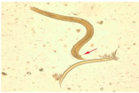 Gambar 2.10 Cacing Strongyloides stercoralis