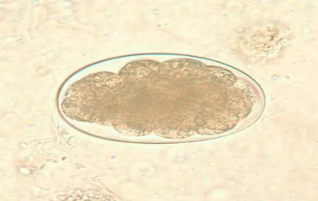 Gambar 3. Telur Hookworm (CDC, 2013b) 