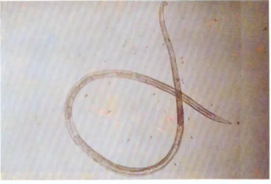 Gambar 2.4.1 Cacing Strongyloides stercoralis  (Pinardi Hadidjaja dan Srisasi Gandahusada, 2002) 