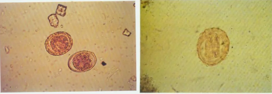 Gambar 2.1.1 Telur Ascaris lumbricoides   (Pinardi Hadidjaja dan Srisasi Gandahusada, 2002) 