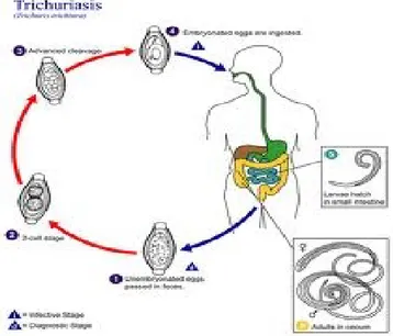 Gambar 4. Siklus Hidup Trichuris trichiura 3) Diagnosis