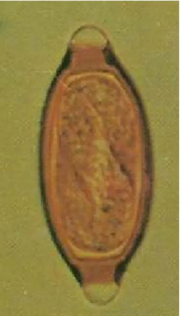 Gambar 1 : telur cacing A. lumbricoides ;   (Juni Prianto L.A., 2003) 