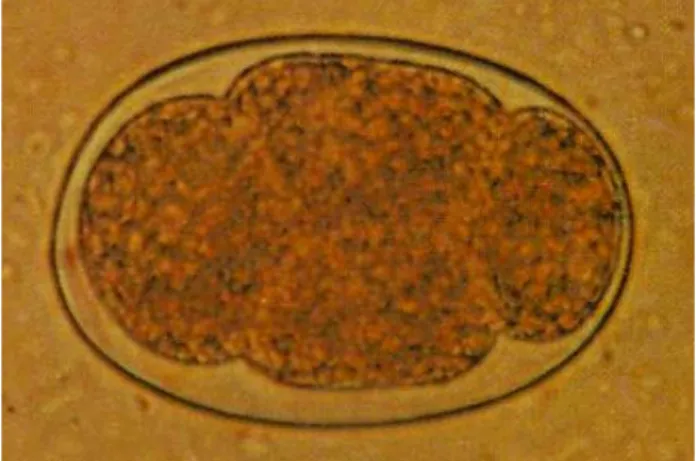 Gambar 2 : telur cacing T. trichiura. 