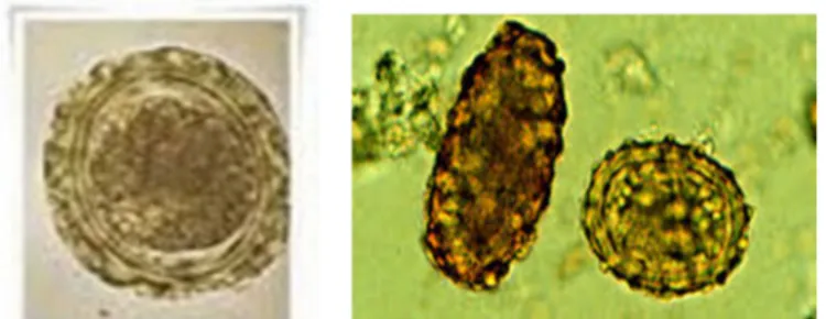 Gambar 2. Telur Ascaris lumbricoides (Widoyono, 2011). 
