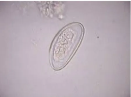 Gambar 2.1 Telur cacing E. vermicularis.(Purnomo,2003) 