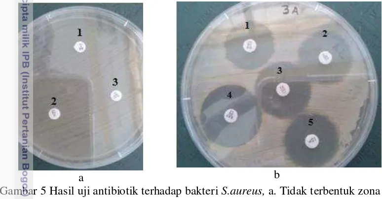 Gambar 5 Hasil uji antibiotik terhadap bakteri S.aureus, a. Tidak terbentuk zona 
