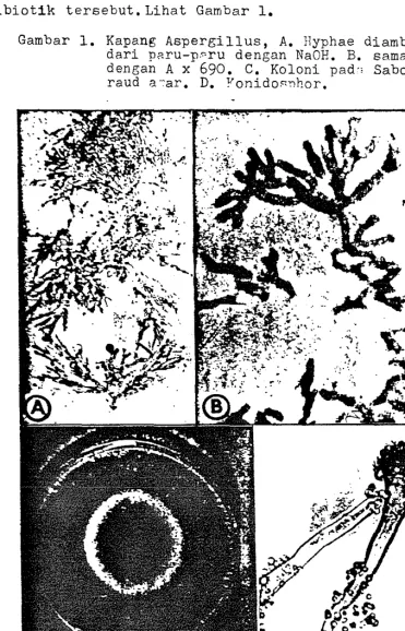 Gambar 1. Kapang Aspergillus, A. Hyphae diambil 
