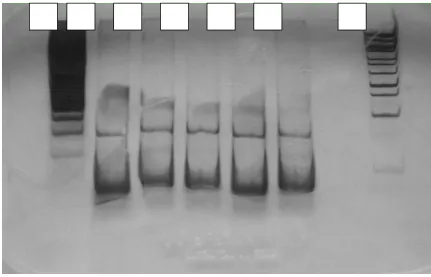 Figure 2. The RFLP result of  E. tarda (lane 1-5) used AluI enzyme. The sequens isolate  in lane 1, 