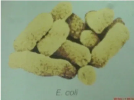 Gambar 4 .  Bacillus cereus 