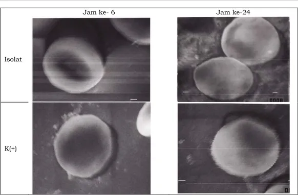 Gambar  2.  Pengamatan eritraosit terinfeksi P.falciparum dengan Scanning Electrone  Microscope (perbesaran 10.000 kali)