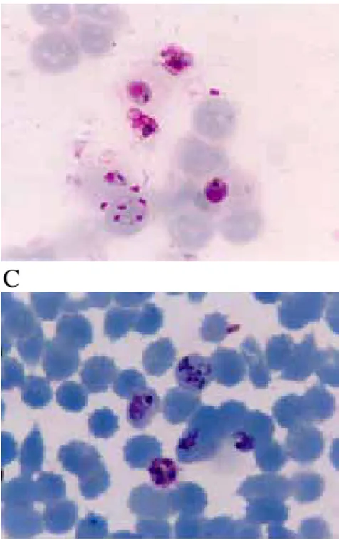Gambar 3. Stadium Parasit P. falciparum Pada Hapusan Darah Tipis Dengan  Pewarna Giemsa (Dokumentasi penelitian) 
