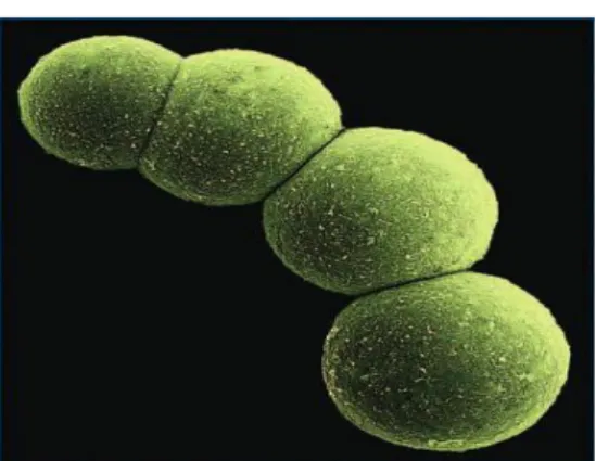 Gambar 2 . Staphylococcus aureus (Cook dan Cook, 2008)  Bacillus cereus 
