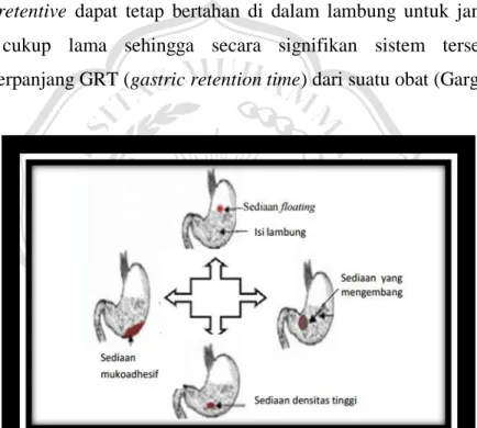 Gambar 1.Ilustrasi sistem penghantaran obat gastroretentive (Rajurkar et al., 2013). 