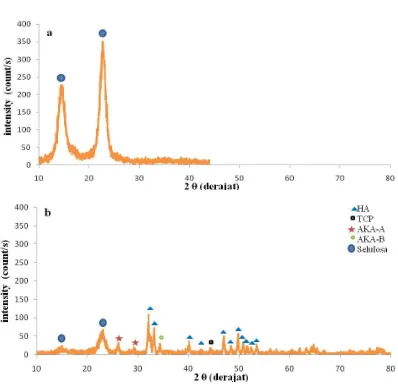 Gambar 6 Pola XRD sampel yang dihasilkan : (a) Selulosa bakteri nata de coco,                       (b) komposit HA/selulosa 