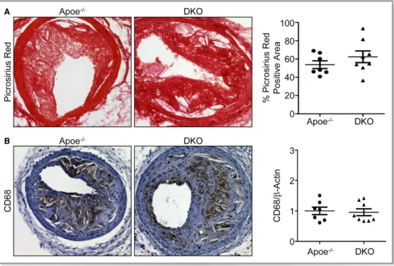 Figure 5. Apoe / and DKO plaques are similar with respect to collagen and macrophage content