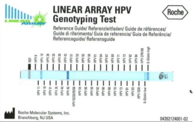 Gambar 2. Hasil scan genotyping sampel kode HPV-163 terinfeksi HPV tipe 45 