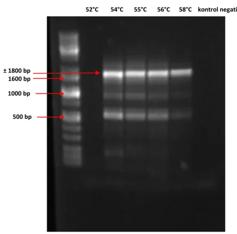 Gambar 5.  Hasil elektroforesis produk PCR dengan menggunakan primer set 1 