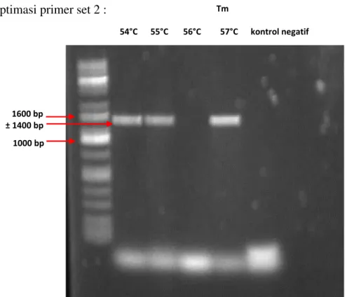 Gambar 7. Hasil elektroforesis produk PCR dengan menggunakan primer set 2 
