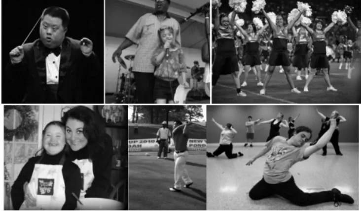 Gambar 1. Ciri down syndrome  Sumber:http://schoolworkhelper.com; 