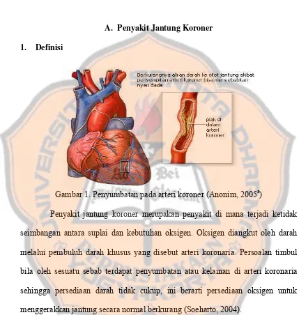 Gambar 1. Penyumbatan pada arteri koroner (Anonim, 2005 a) 