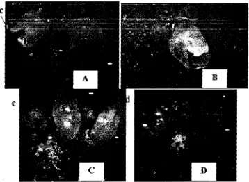 Gambar 2. Pengamatan Mikroskopis pada Kalus Embriogenik Kastuba : (A- D) Sebagian tahap perkembangan embrio ciari felSe (a) ke fase pradikotiledonari (b) dan dikotiledonari (c); (d) embrio abnormal denganjwnlah calon kotiledon lebih dari 2