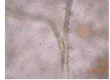 Gambar 3  Cendawan Rhizoctonia solani pada mikroskop 