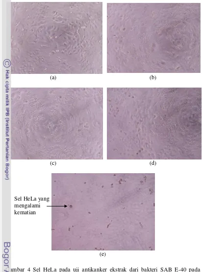 Gambar 4 Sel HeLa pada uji antikanker ekstrak dari bakteri SAB E-40 pada 