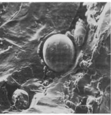 Figure 2.3: Spherical wear particles produced by sliding wear process (Hurricks, 1974) 