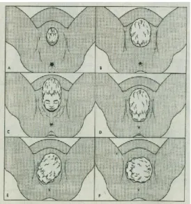Gambar 2.8 Proses kelahiran kepala [15] 