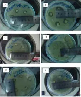 Tabel  1.  Zona  hambat  ekstrak  Halimeda  renchii dan Euchema cottonii  