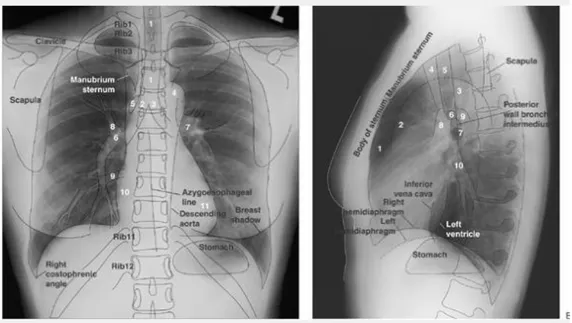 Gambar 4.  Struktur  anatomis  normal  pada  radiograf  posteroanterior  (PA)  dan  Lateral