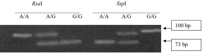 Figure 1.   Elektroforesis agarose gel 3%,  Seyama et. al (2006).  