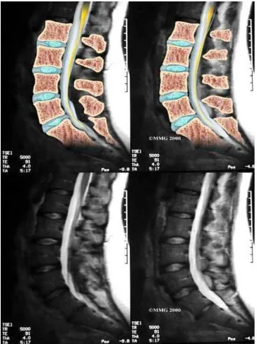 Gambar 7. Hasil lumbar spine