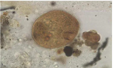 Gambar 7.  Sumber : Ichthyopthyrius multifiliis http://www.google.com/imgres (2014) 