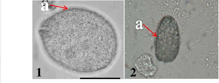Gambar 11  Balantidium sp. pada: 1). kera (Katerina et al. 2010) dan 2).  