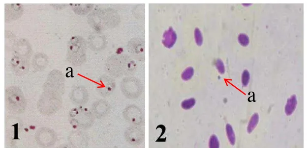 Gambar 15 Plasmodium sp. pada eritrosit, 1). gametosit Plasmodium falciparum (Assafa et al