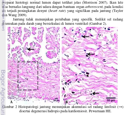 Gambar 2 Histopatologi jantung menunjukan akumulasi sel radang limfosit ( →