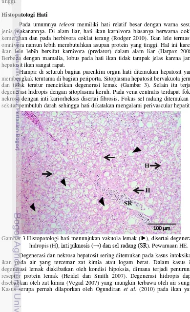 Gambar 3 Histopatologi hati menunjukan vakuola lemak ( ►), disertai degenerasi 